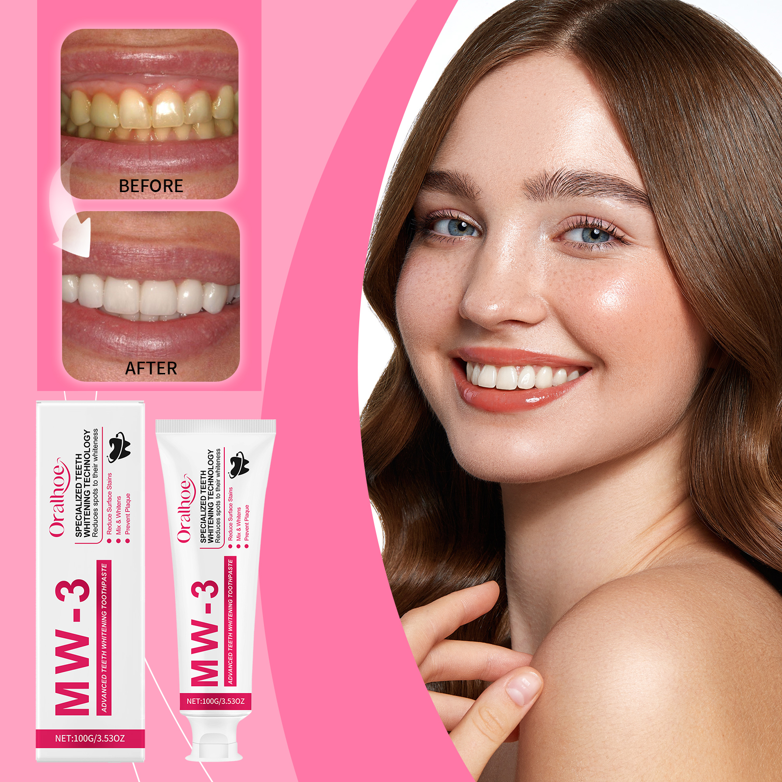 ORALHOE Advanced Teeth Whiteni – Teeth Whitening Or Tooth Whitening Bewertung und Preis