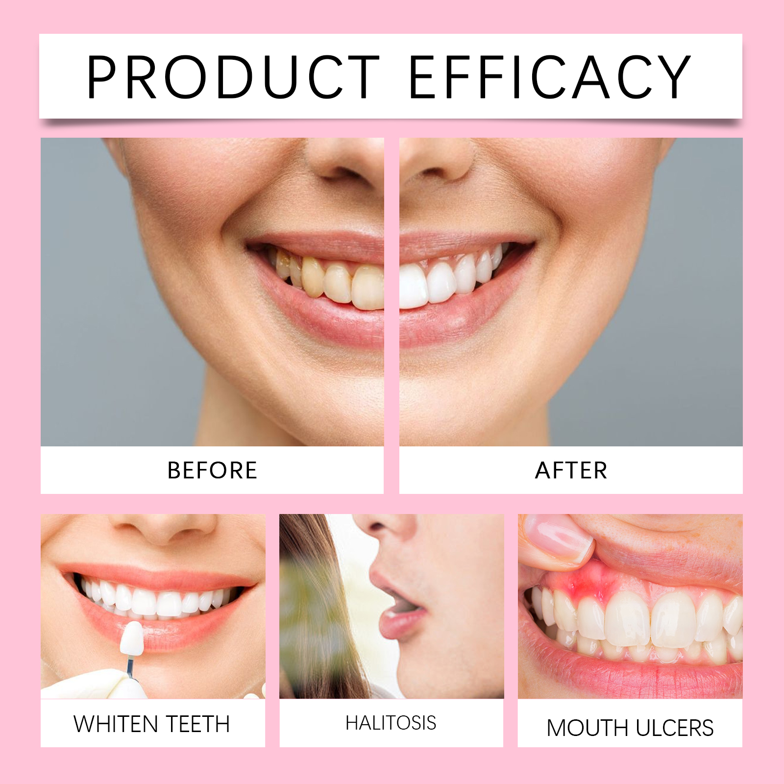 ORALHOE Advanced Teeth Whiteni – Teeth Whitening Or Tooth Whitening Bewertung und Preis