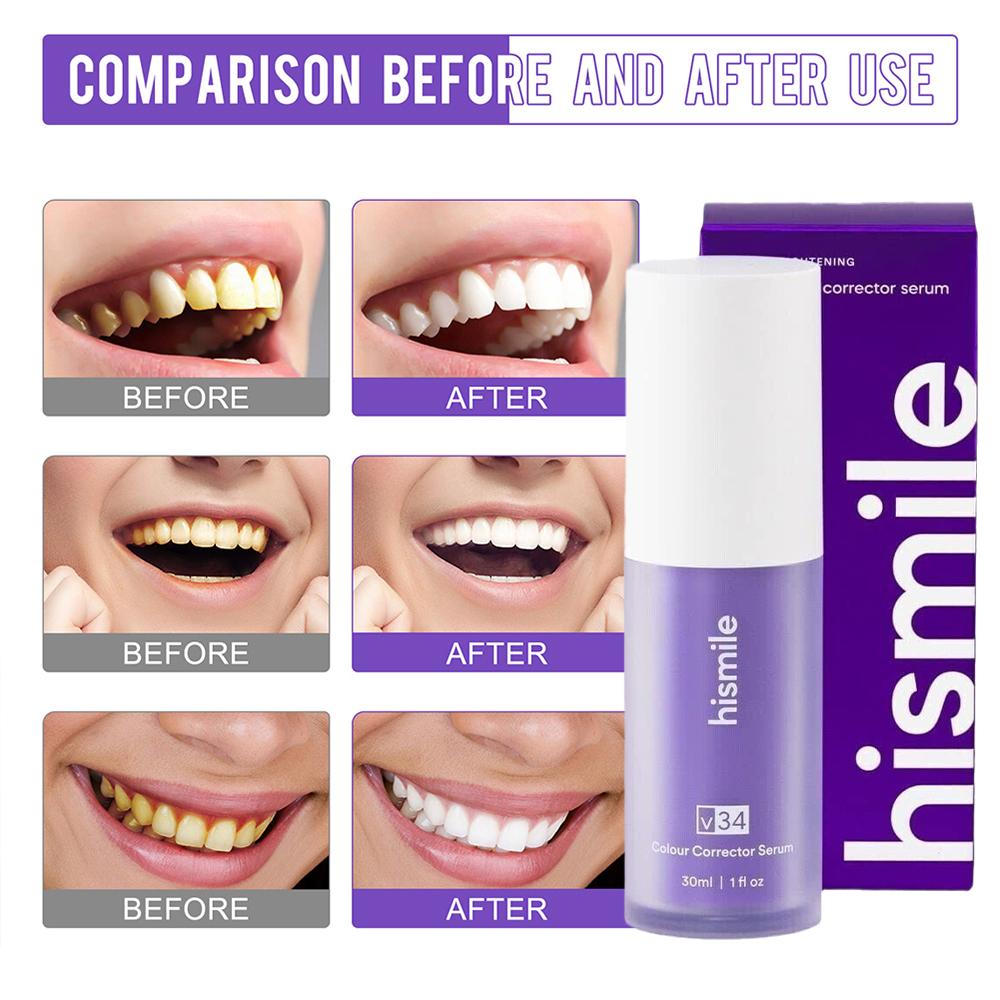 30ml Hismile V34 Purple Teeth  – Teeth Whitening Serum Bewertung und Preis