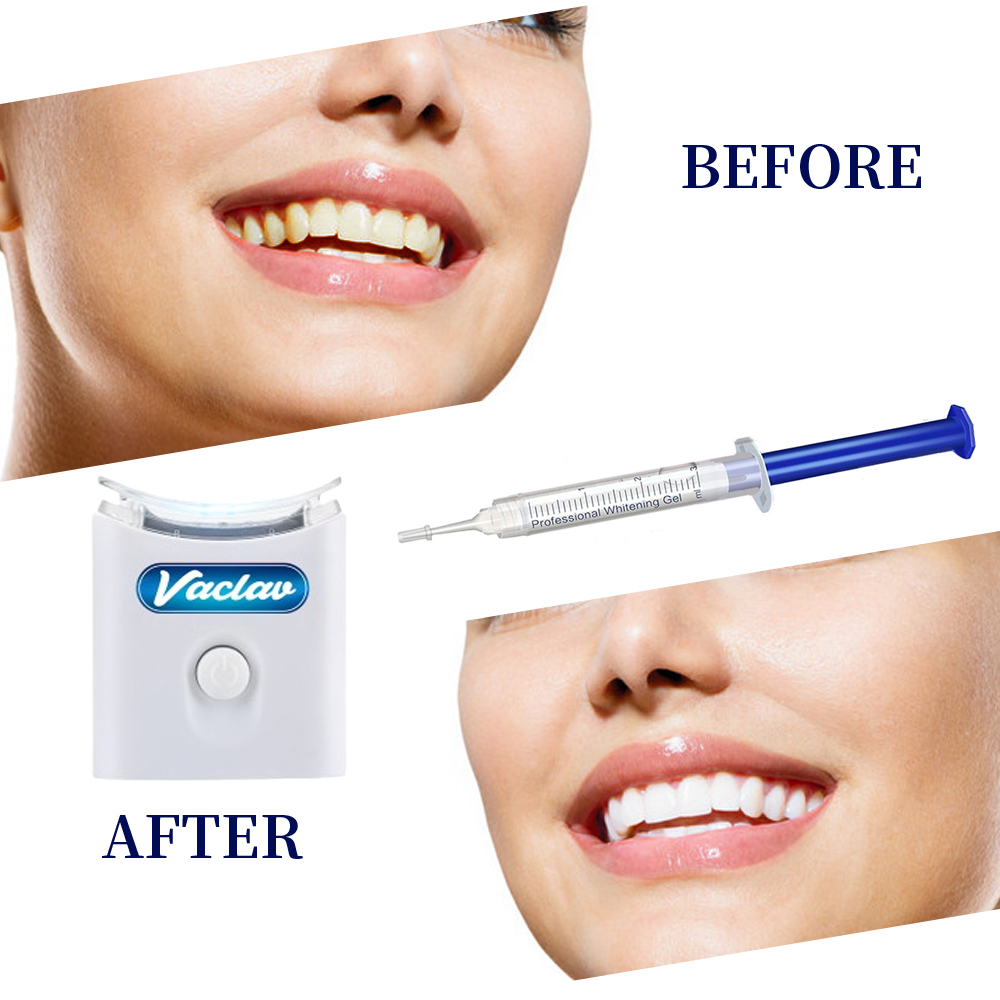 Mint Teeth Whitening Gel Syrin – Teeth Whitening Gel Syringes Bewertung und Preis