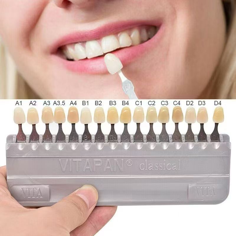 VITA 16 Colors Teeth Shade Gui – Whitening Teeth Dentist Bewertung und Preis