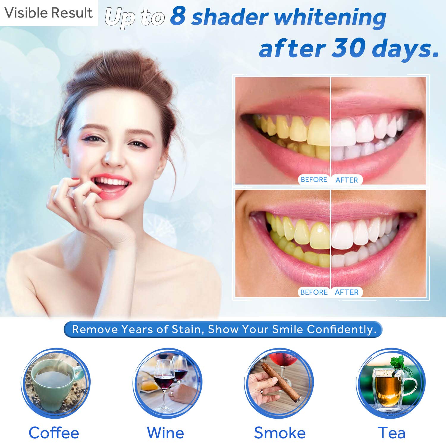 Teeth Whitening Gel Refill Syr – Teeth Whitening Gel Syringes Bewertung und Preis