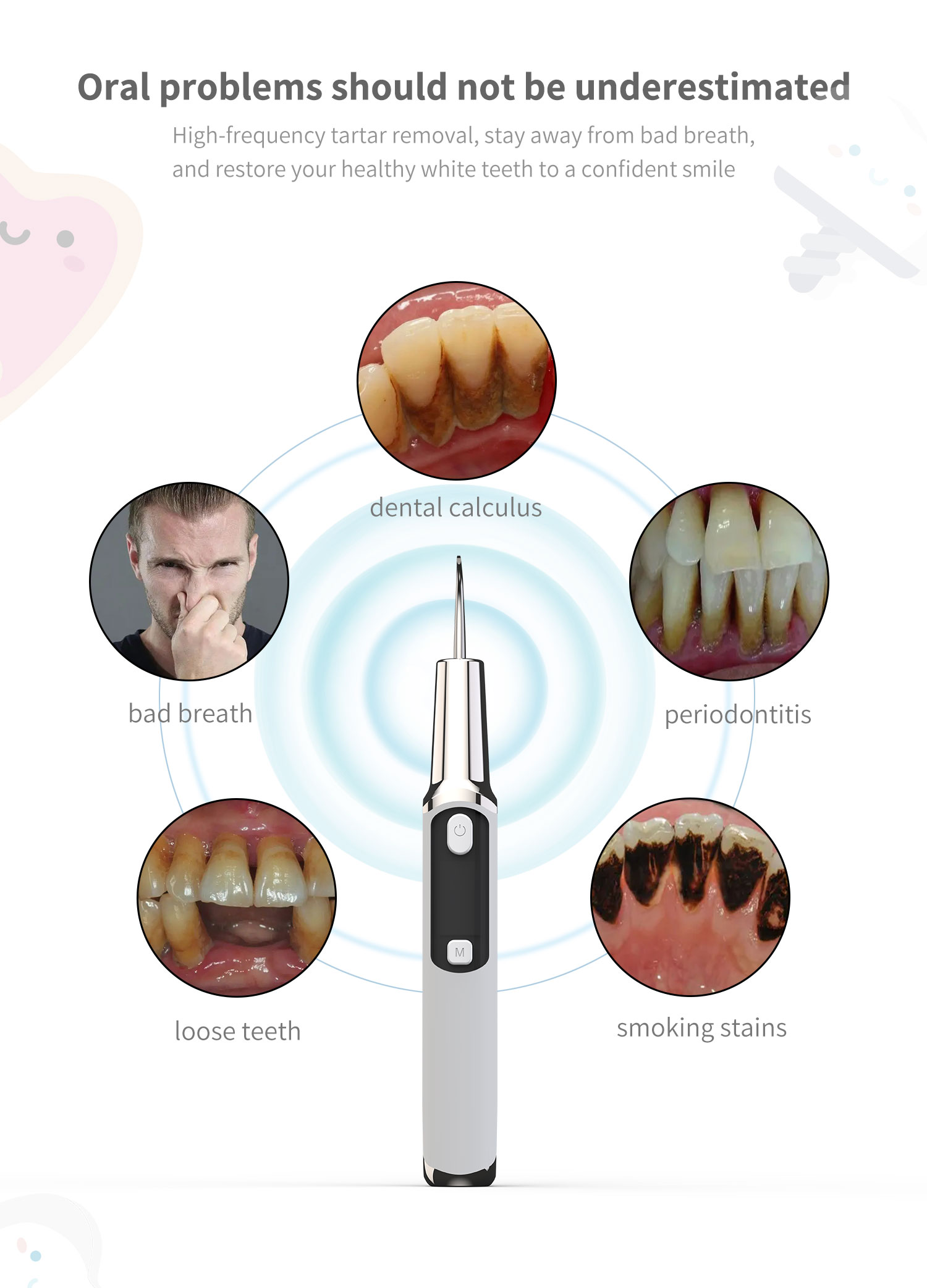 Electric Sonic Dental Calculus – Teeth Whitening Or Tooth Whitening Bewertung und Preis