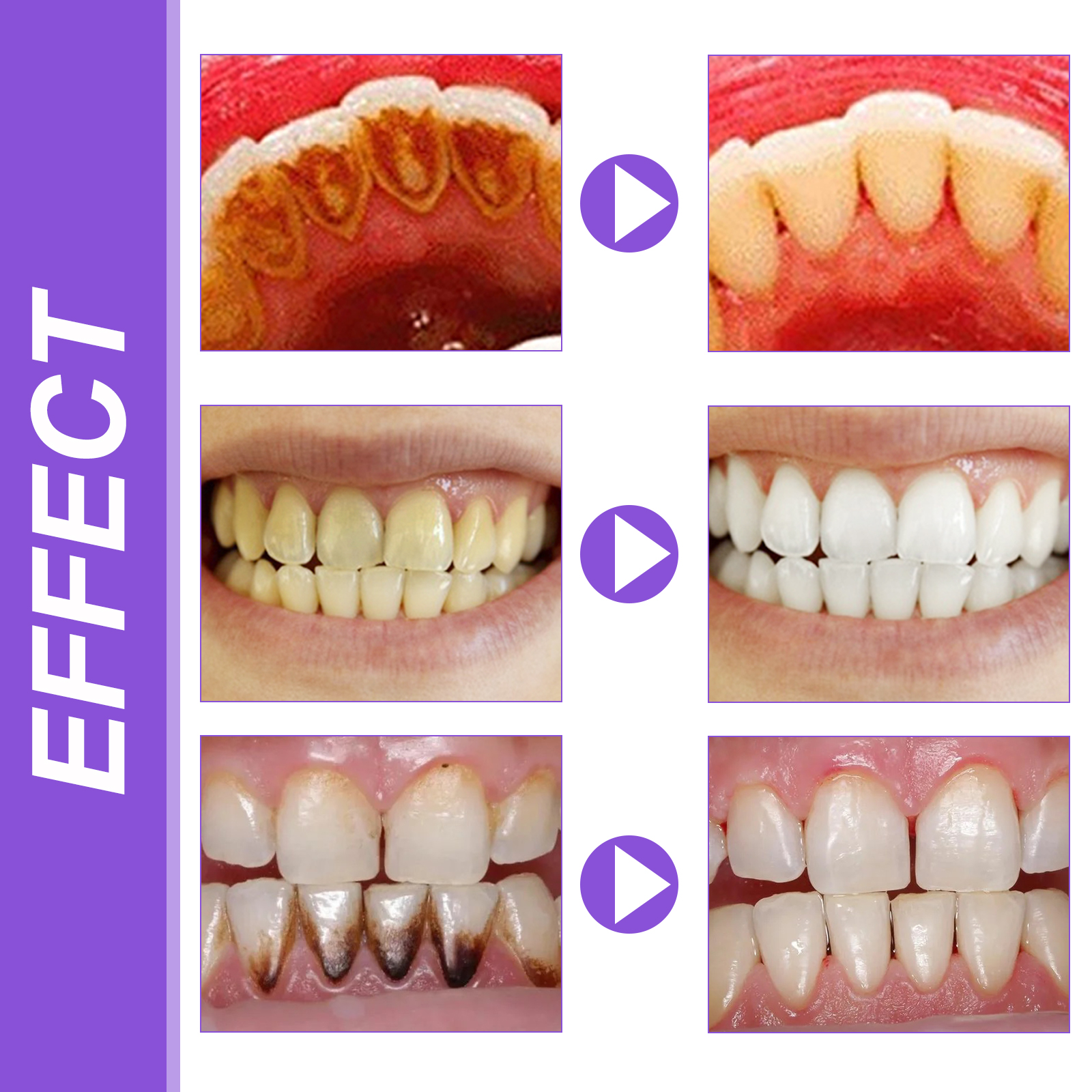 EELHOE Smiles Bright White Ref – Teeth Whitening Serum Bewertung und Preis