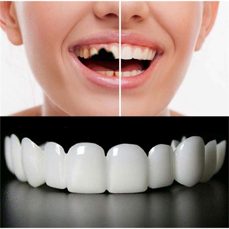 Reusable Temporary False Teeth – Teeth Whitening Uneven Bewertung und Preis