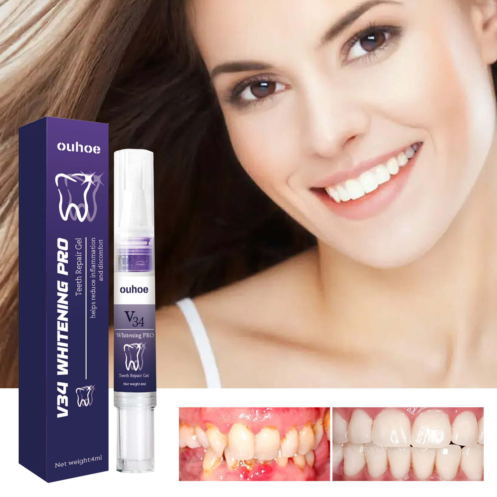 Rapid Repair Damaged Gums Gel  – Teeth Whitening Serum Bewertung und Preis