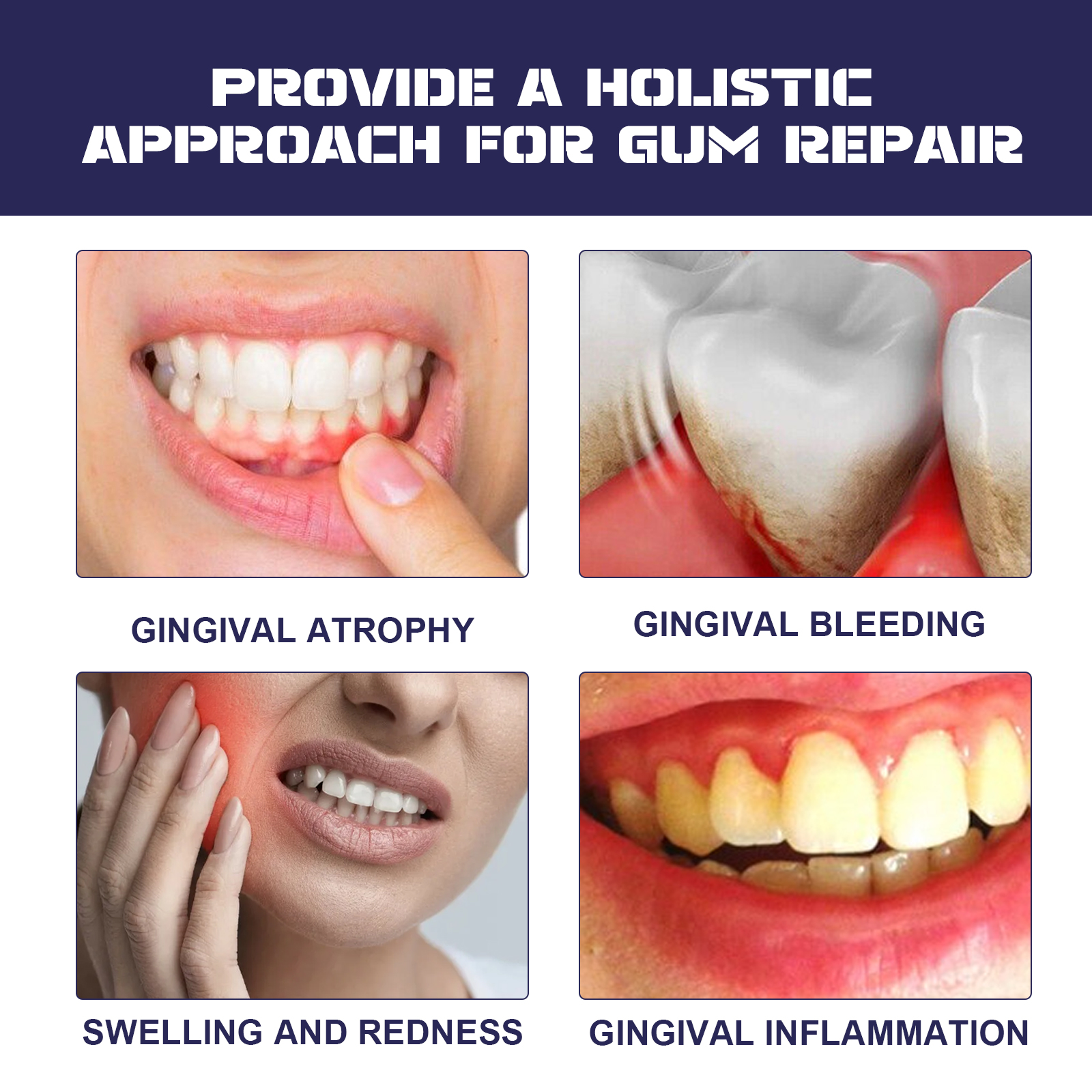 Rapid Repair Damaged Gums Gel  – Teeth Whitening Serum Bewertung und Preis