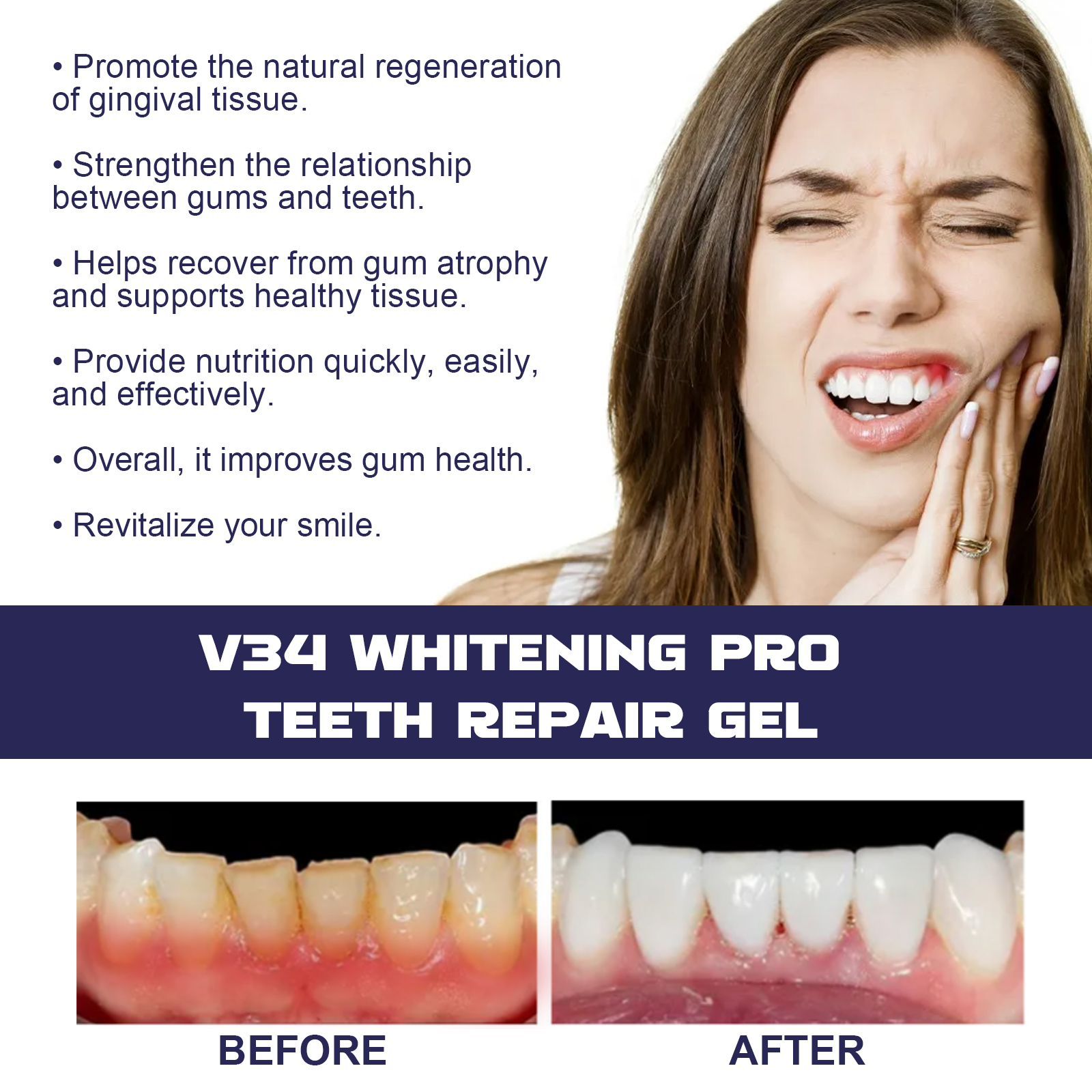Rapid Repair Damaged Gums Gel  – Teeth Whitening Serum Bewertung und Preis