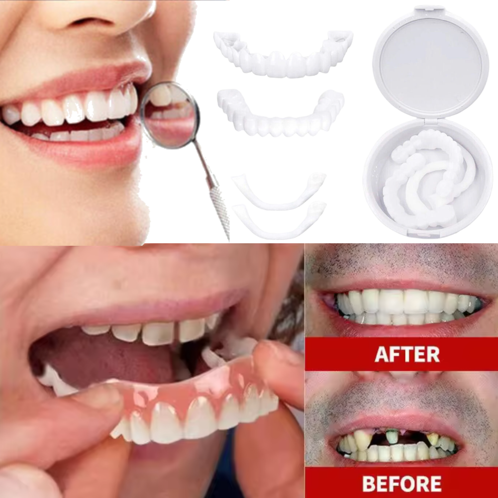 Charming Smile Teeth Veneers,  – Teeth Whitening Uneven Bewertung und Preis