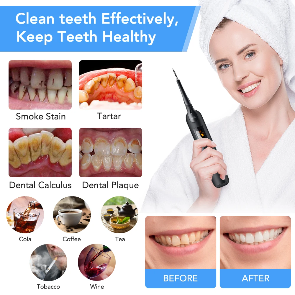 Electric Dental Scaler Toothbr – Teeth Whitening Or Tooth Whitening Bewertung und Preis