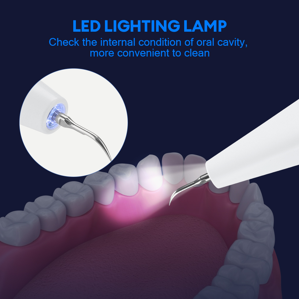Ultrasonic Dental Calculus Rem – Whitening Teeth Dentist Bewertung und Preis