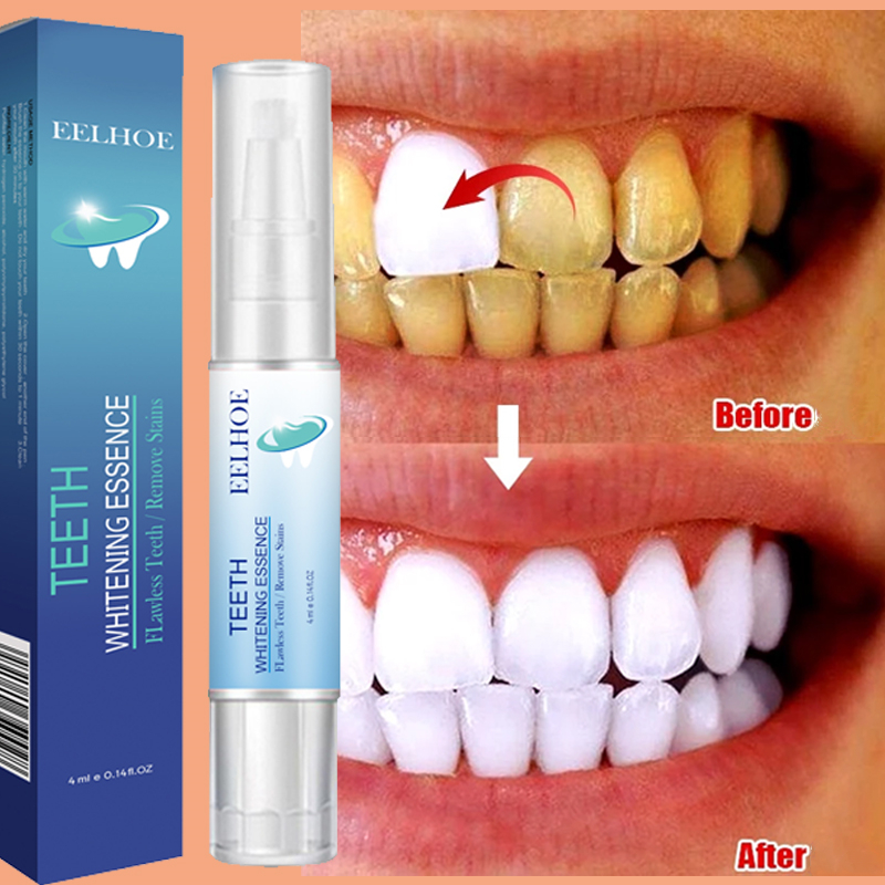 Teeth Whitening Pen Dental Ess – Teeth Whitening Serum Bewertung und Preis