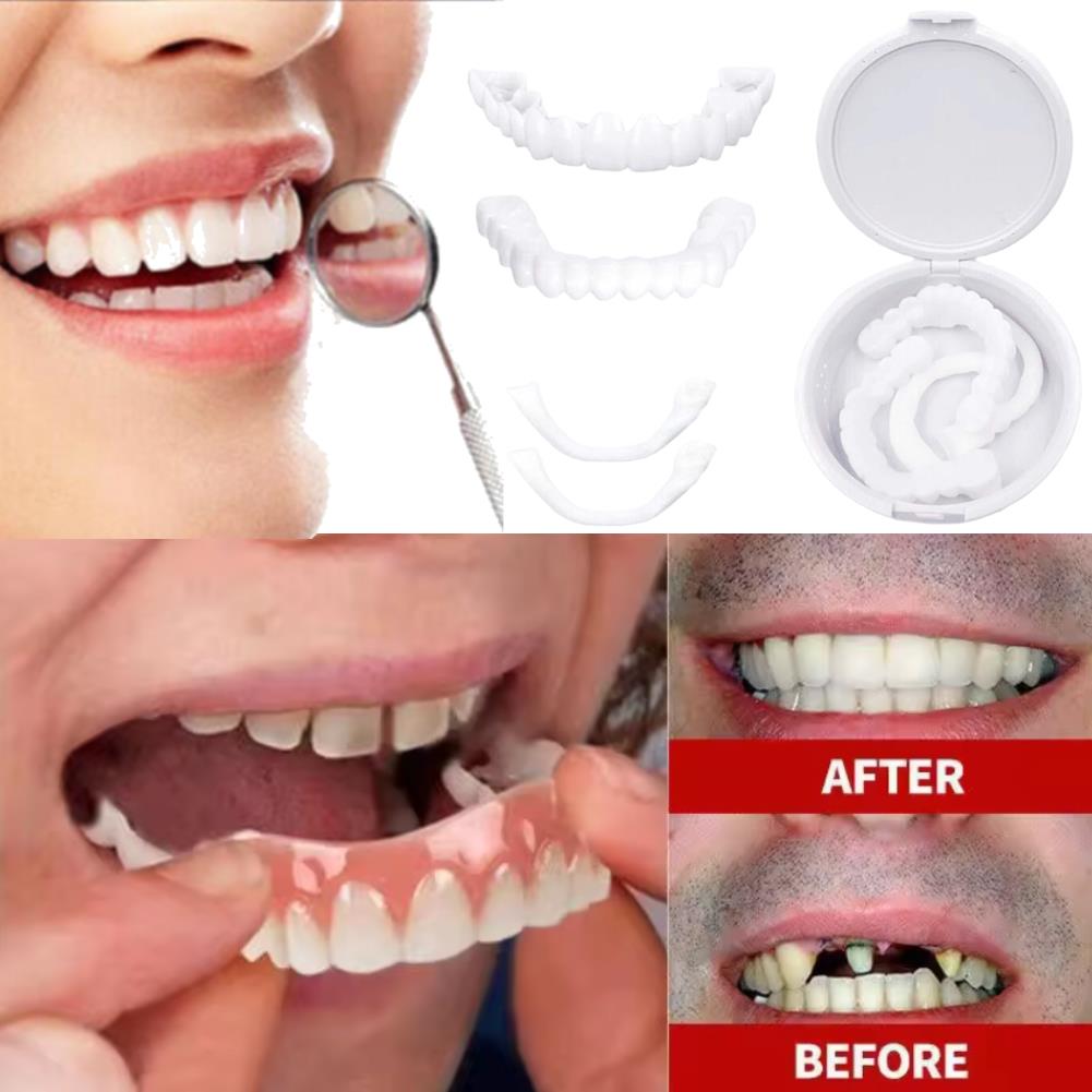 New Charming Smile Teeth Venee – Teeth Whitening Uneven Bewertung und Preis