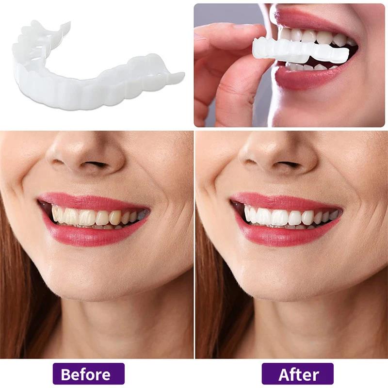 New Defect Repair Teeth Veneer – Teeth Whitening Uneven Bewertung und Preis