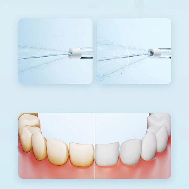 Xiaomi Portable Oral Irrigator – Teeth Whitening Or Tooth Whitening Bewertung und Preis