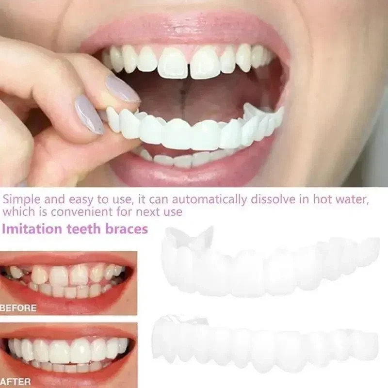 Charming Smile Teeth Veneers,  – Teeth Whitening Uneven Bewertung und Preis