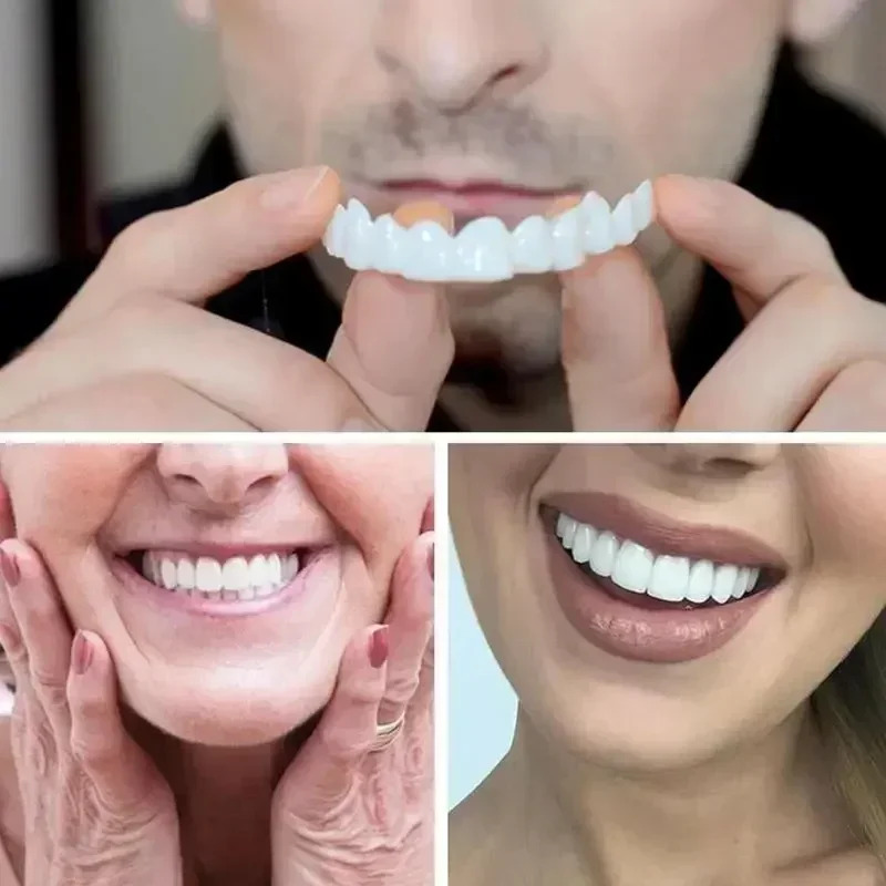 Charming Smile Teeth Veneers,  – Teeth Whitening Uneven Bewertung und Preis