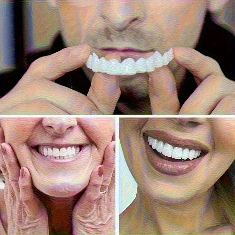 New Uneven Teeth Fix Veneers R – Teeth Whitening Uneven Bewertung und Preis