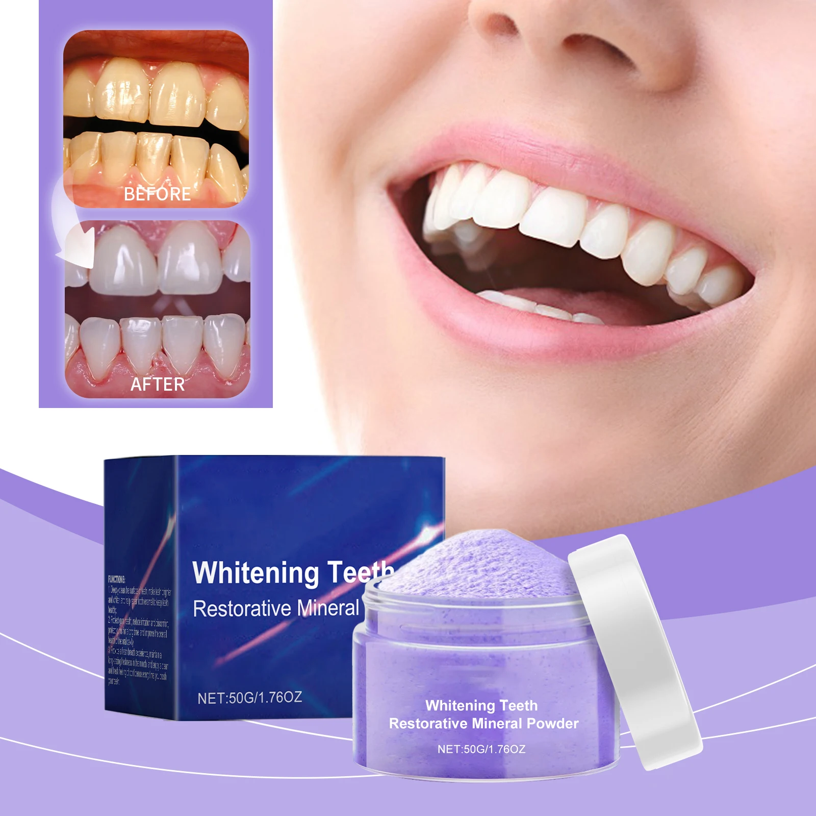 2Nd Upgraded Teeth Whitening T – Teeth Whitening Serum Bewertung und Preis