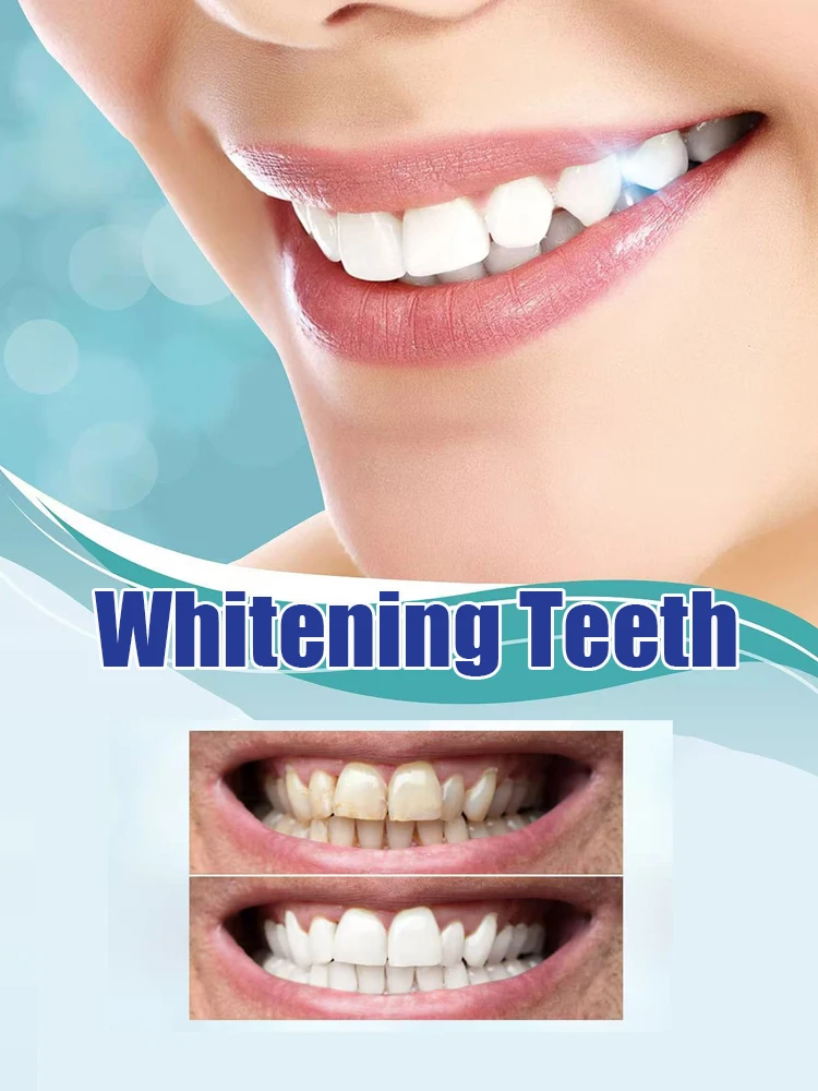 Newly Upgraded Teeth Whitening – Teeth Whitening Serum Bewertung und Preis