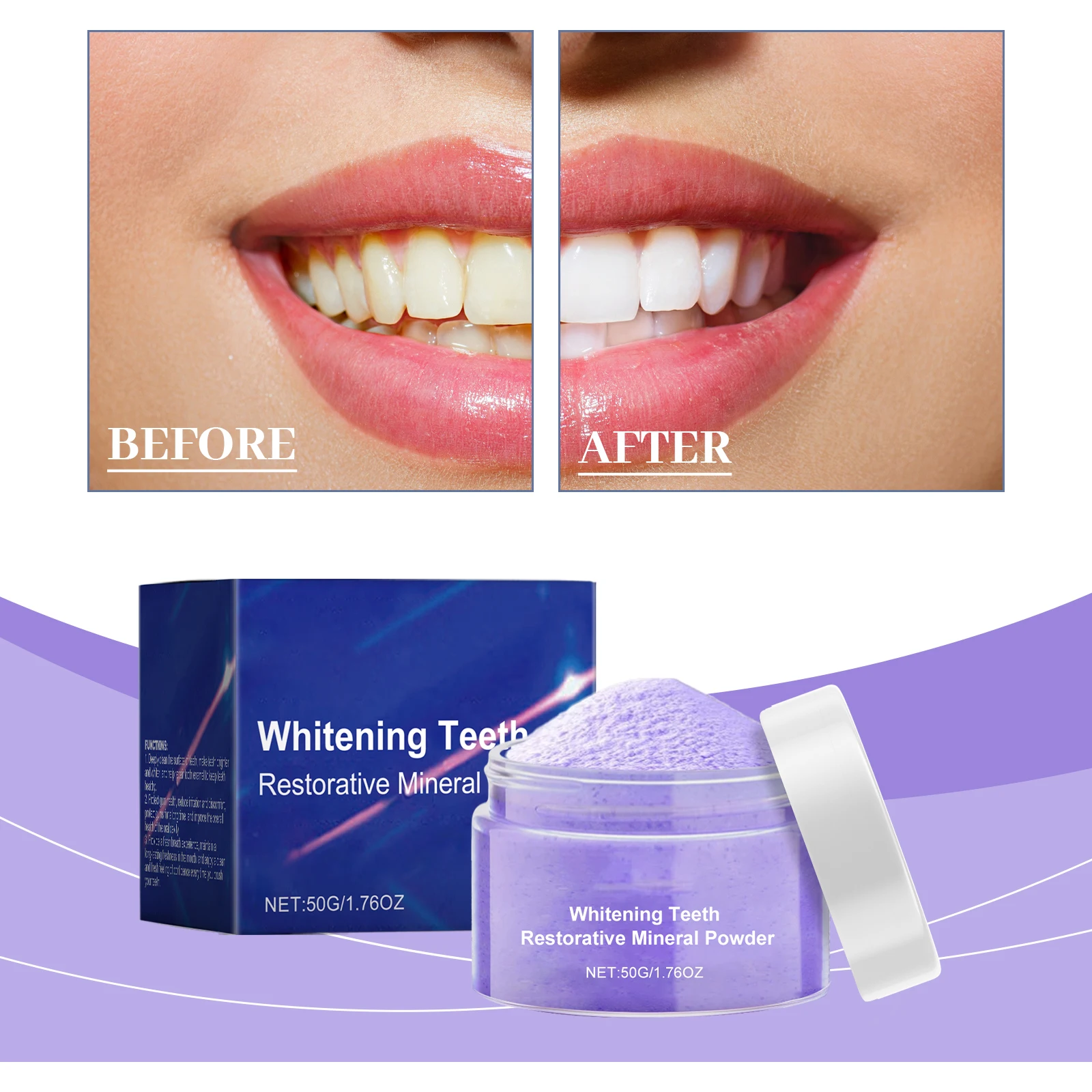 Newly Upgraded Teeth Whitening – Teeth Whitening Serum Bewertung und Preis