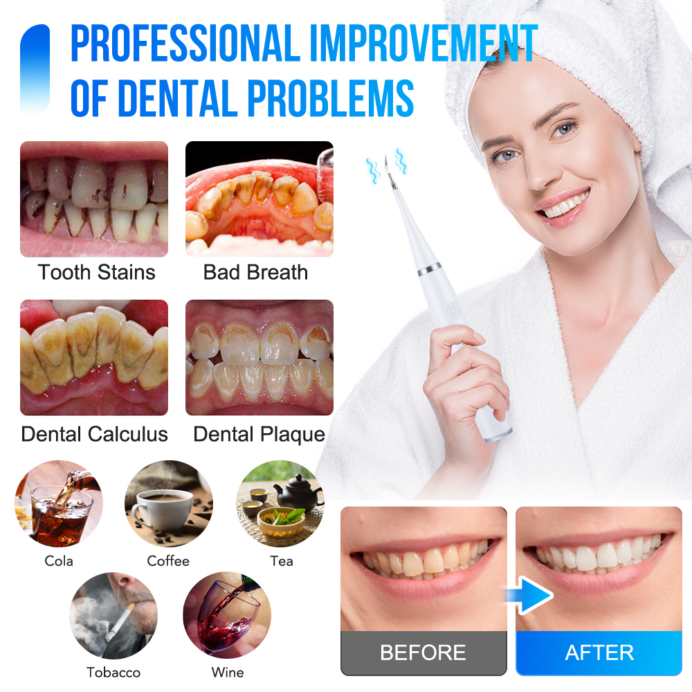 Household Electric Teeth Clean – Teeth Whitening Or Tooth Whitening Bewertung und Preis