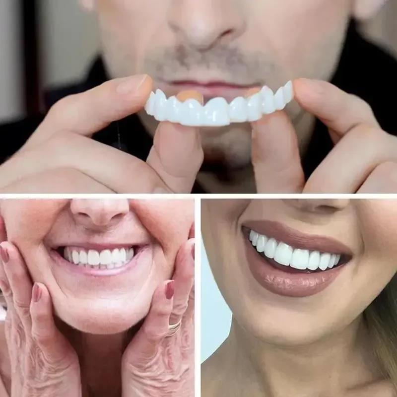New Charming Smile Teeth Venee – Teeth Whitening Uneven Bewertung und Preis