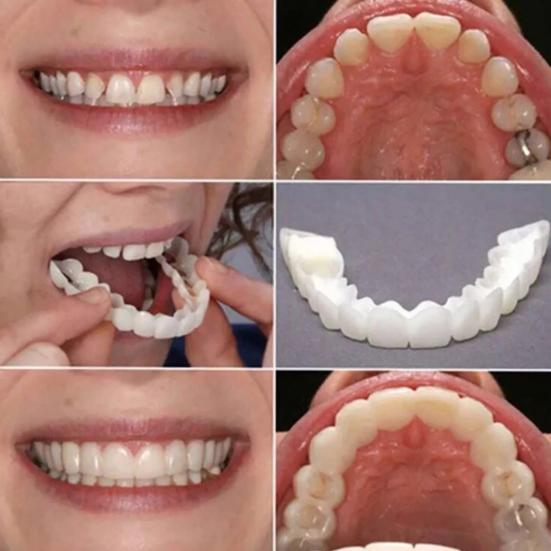 New Reusable Temporary False T – Teeth Whitening Uneven Bewertung und Preis