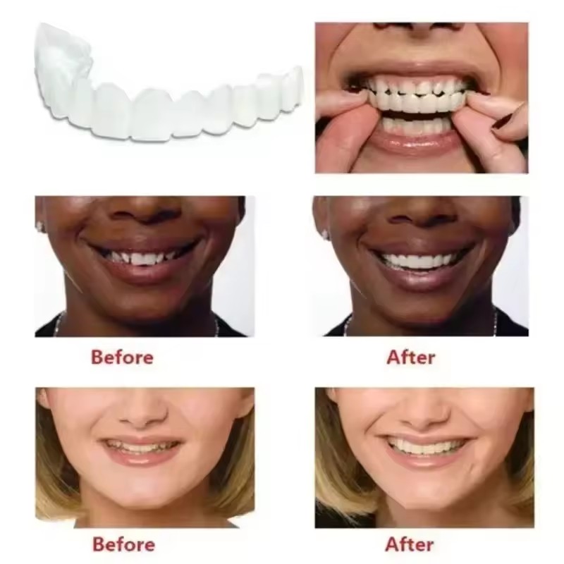 New Reusable Temporary False T – Teeth Whitening Uneven Bewertung und Preis