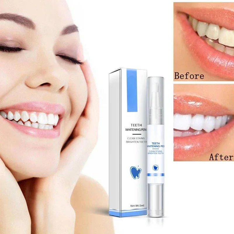 Teeth Whitening Pen Cleaning S – Teeth Whitening Serum Bewertung und Preis