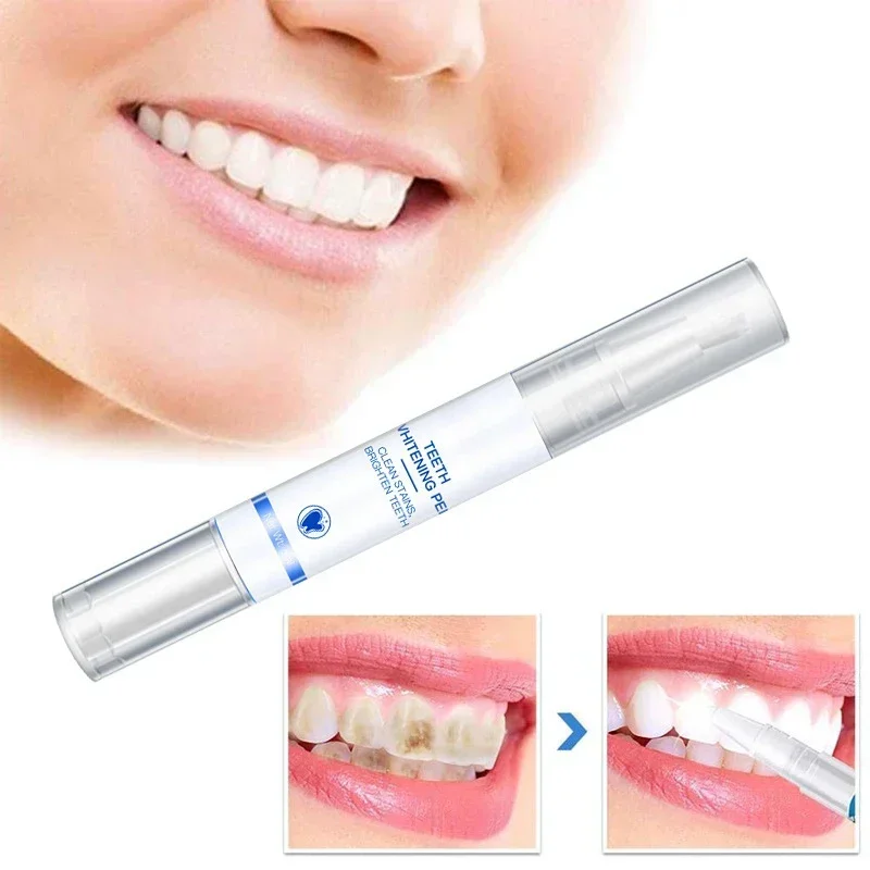 Teeth Whitening Pen Cleaning S – Teeth Whitening Serum Bewertung und Preis