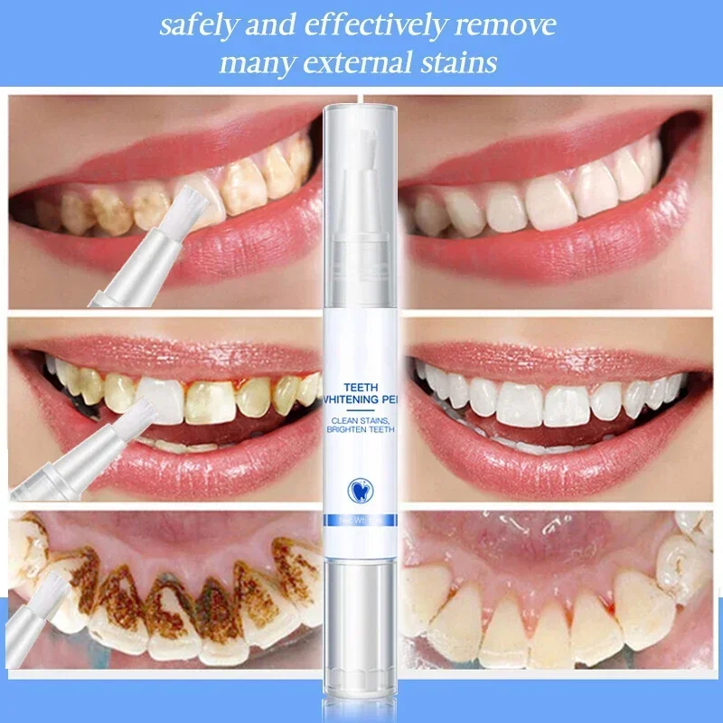 Teeth Whitening Pen Cleaning S – Teeth Whitening Serum Bewertung und Preis